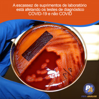 A escassez de suprimentos de laboratório está afetando os testes de diagnóstico COVID-19 e não COVID