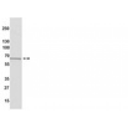 ODUTO IMUNOLOGICO ANTI-ESTROGENO RECEP A HUM CLONE 60C IGG COE IP/WB TEMPERATURA TRANSPORTE/ARMAZENAMENTO -20C 100UL (UND) MILLIPORE ODUTO IMUNOLOGICO ANTI-ESTROGENO RECEP A HUM CLONE 60C IGG COE IP/WB TEMPERATURA TRANSPORTE/ARMAZENAMENTO -20C 100UL (UND) MILLIPORE