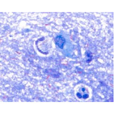 SOLUÇÃO DE AZUL DE METILENO DE LOFFLER MERCK - 500ML