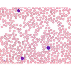 EOSINA AZUL DE METILENO SEG. MAY GRUNWALD MERCK (500 ML)