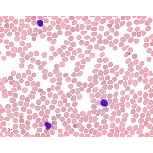 EOSINA AZUL DE METILENO SEG. MAY GRUNWALD MERCK (500 ML) EOSINA AZUL DE METILENO SEG. MAY GRUNWALD MERCK (500 ML)