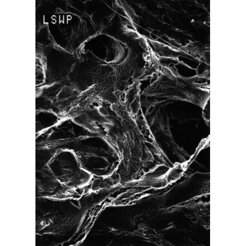 MEMBRANA FILTRANTE HIDROFÓBICA PTFE 25MM, TAM. PORO 5.0 µm MILLIPORE (CX/100 UND) MEMBRANA FILTRANTE HIDROFÓBICA PTFE 25MM, TAM. PORO 5.0 µm MILLIPORE (CX/100 UND)