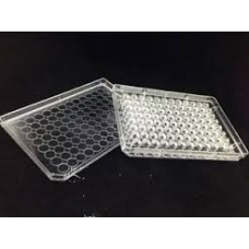 PLACA 96 POÇOS FUNDO EM U PRETA NÃO ESTÉRIL (EMB C/ 100 UND) CORNING PLACA 96 POÇOS FUNDO EM U PRETA NÃO ESTÉRIL (EMB C/ 100 UND) CORNING